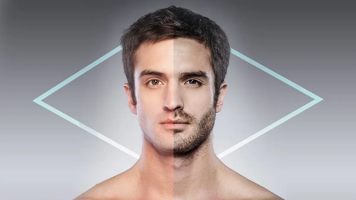 Composición ilustrativa publicada por Kaloni de un rostro con y sin barba; no representa un resultado clínico.